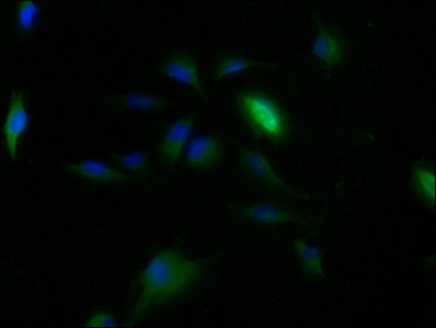 CLRN2 Antibody in Immunocytochemistry (ICC/IF)