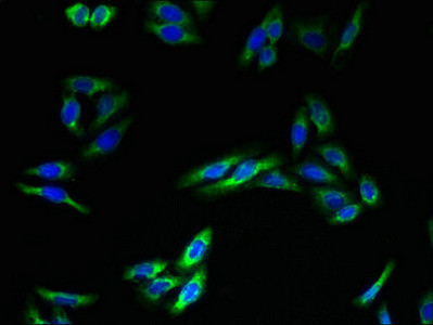 TMEM140 Antibody in Immunocytochemistry (ICC/IF)