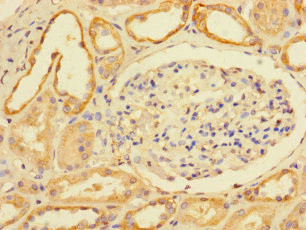 MTRES1 Antibody in Immunohistochemistry (Paraffin) (IHC (P))