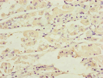 DCTN6 Antibody in Immunohistochemistry (Paraffin) (IHC (P))