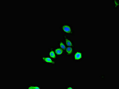 SBF2 Antibody in Immunocytochemistry (ICC/IF)