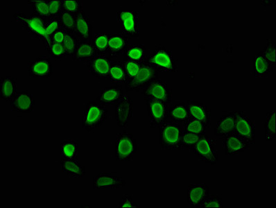 H4K5me1 Antibody in Immunocytochemistry (ICC/IF)