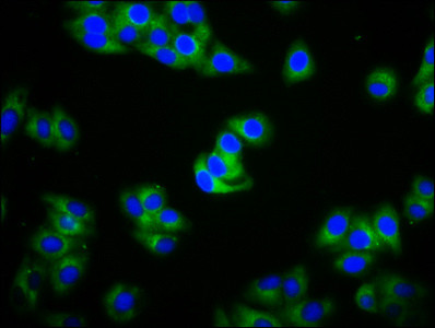 IGHA2 Antibody in Immunocytochemistry (ICC/IF)