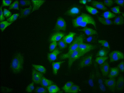 OTOP1 Antibody in Immunocytochemistry (ICC/IF)