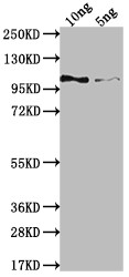 Genome polyprotein Antibody in Western Blot (WB)