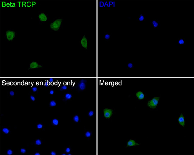 BTRC Antibody in Immunocytochemistry (ICC/IF)