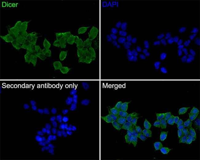 Dicer Antibody in Immunocytochemistry (ICC/IF)