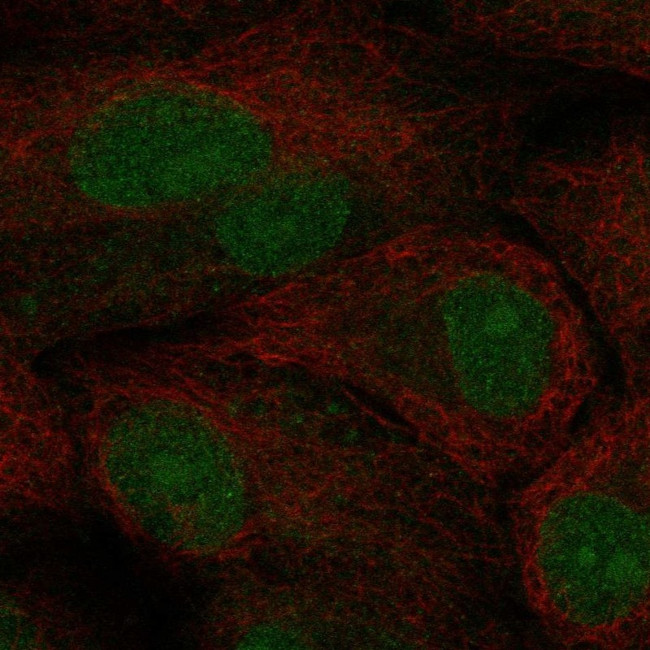 TCF21 Antibody in Immunocytochemistry (ICC/IF)