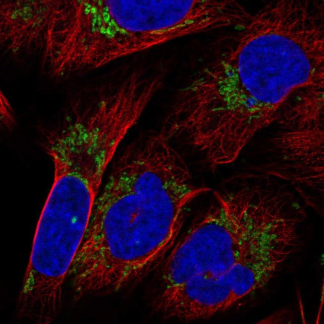 KLHL29 Antibody in Immunocytochemistry (ICC/IF)