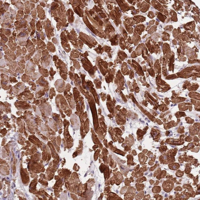 PPP1R14C Antibody in Immunohistochemistry (Paraffin) (IHC (P))