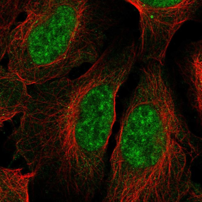 HSPB9 Antibody in Immunocytochemistry (ICC/IF)