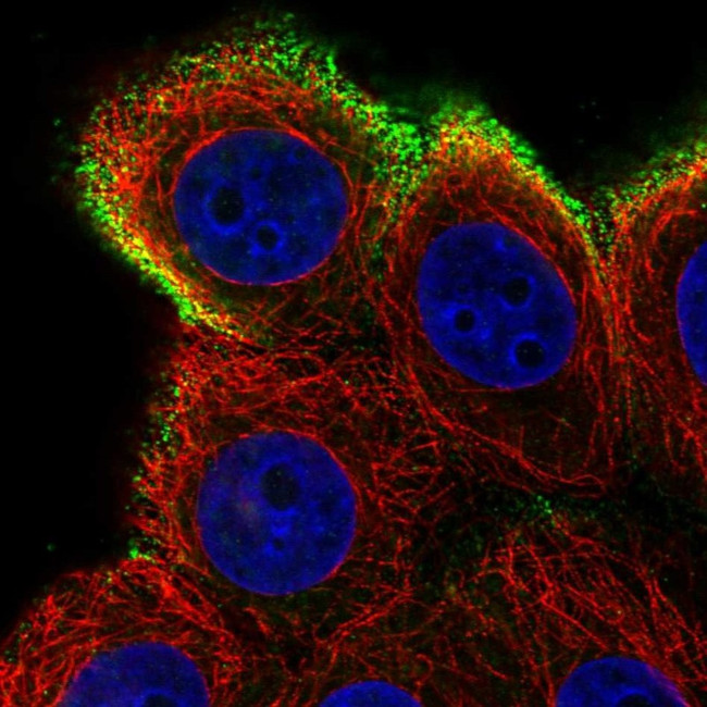 AMIGO1 Antibody in Immunocytochemistry (ICC/IF)