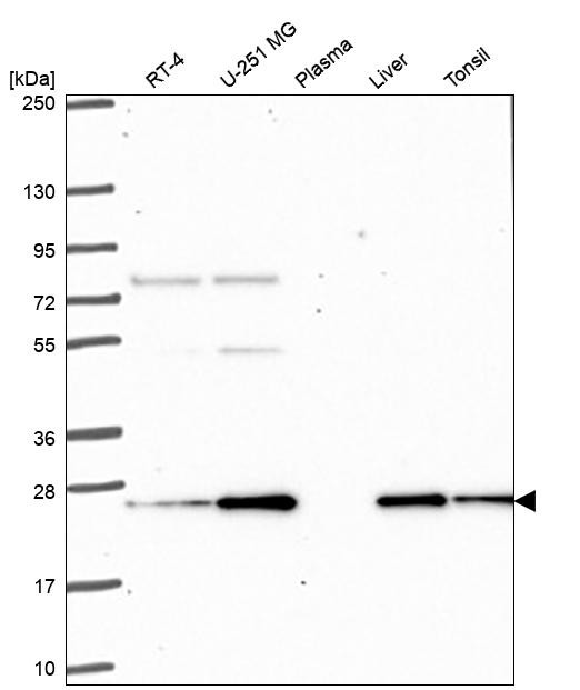 PRDX3 Antibody in Western Blot (WB)