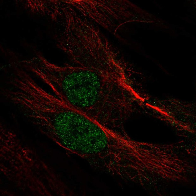 MYF6 Antibody in Immunocytochemistry (ICC/IF)