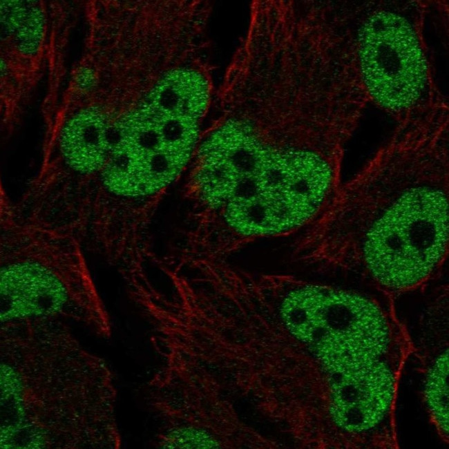 Estrogen Receptor beta Antibody in Immunocytochemistry (ICC/IF)