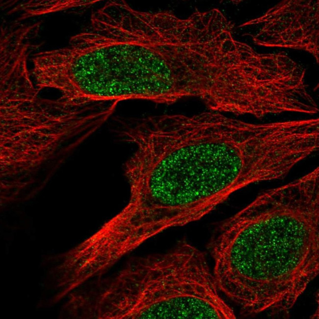 RXRB Antibody in Immunocytochemistry (ICC/IF)