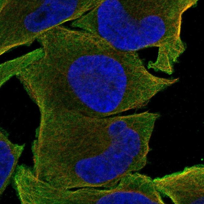 TSLP Receptor Antibody in Immunocytochemistry (ICC/IF)