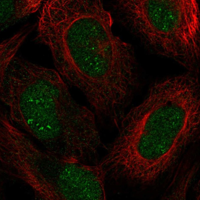 ZNF112 Antibody in Immunocytochemistry (ICC/IF)