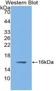 nNOS Antibody in Western Blot (WB)