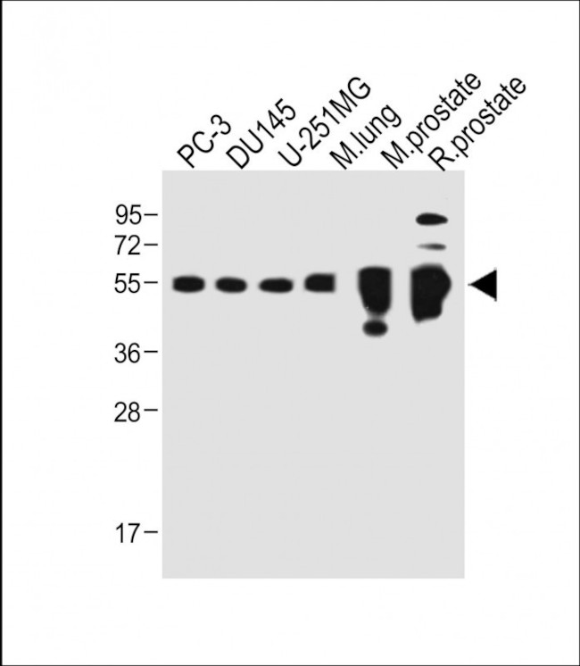 Prostate Specific Acid Phosphatase Antibody in Western Blot (WB)