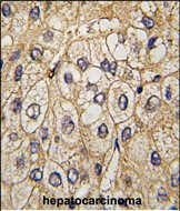 EphA7 Antibody in Immunohistochemistry (Paraffin) (IHC (P))