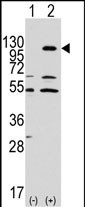 EphA7 Antibody in Western Blot (WB)