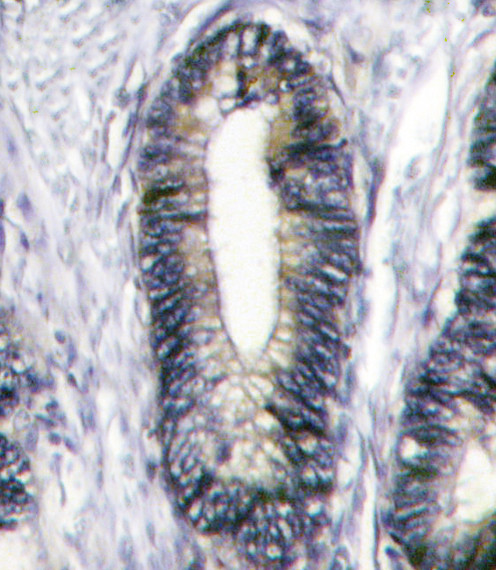 EphB2 Antibody in Immunohistochemistry (Paraffin) (IHC (P))