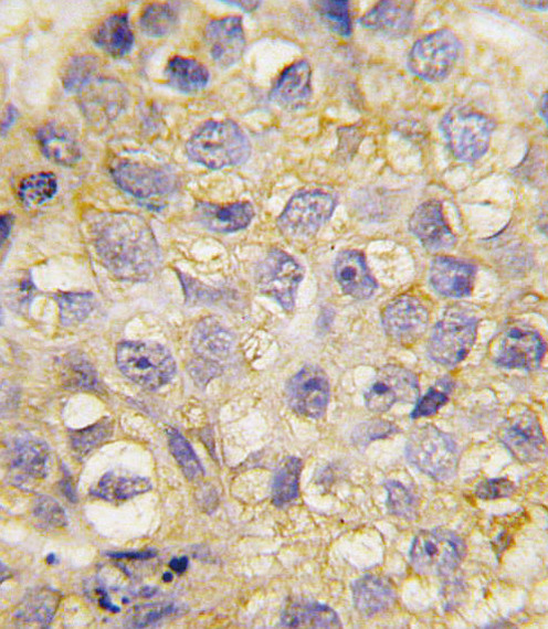 EphB2 Antibody in Immunohistochemistry (Paraffin) (IHC (P))