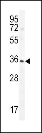 IGFBP3 Antibody in Western Blot (WB)