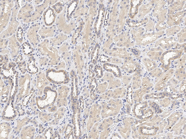 C12orf4 Antibody in Immunohistochemistry (Paraffin) (IHC (P))