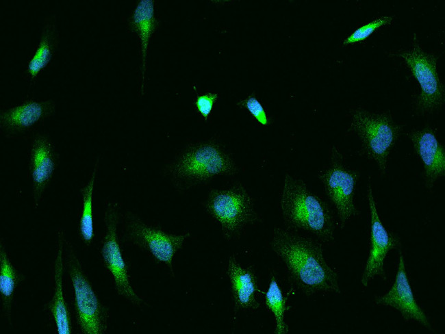 H6PD Antibody in Immunocytochemistry (ICC/IF)