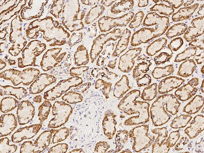 HRASLS2 Antibody in Immunohistochemistry (Paraffin) (IHC (P))