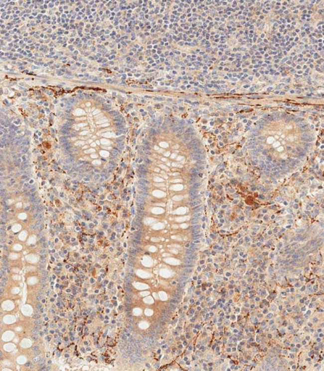 PIK3CD Antibody in Immunohistochemistry (Paraffin) (IHC (P))