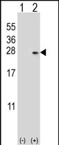 DUSP14 Antibody in Western Blot (WB)