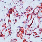 VEGF Receptor 1 Antibody in Immunohistochemistry (Paraffin) (IHC (P))