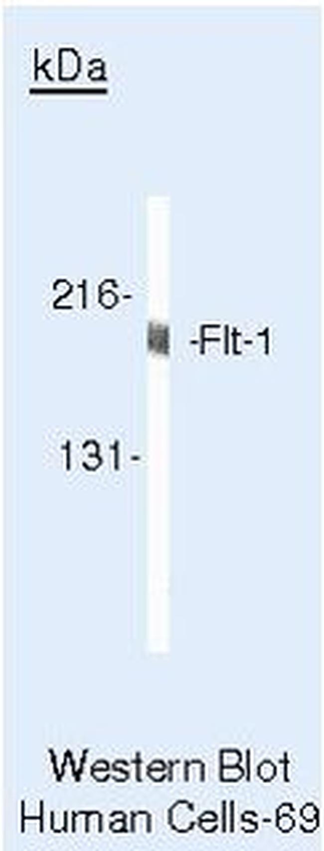 VEGF Receptor 1 Antibody in Western Blot (WB)