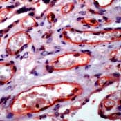 NFkB p65 Antibody in Immunohistochemistry (IHC)