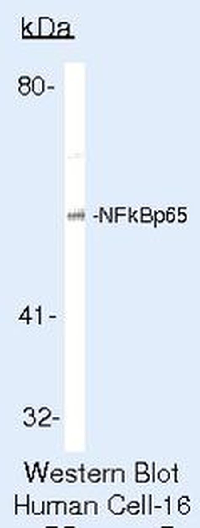 NFkB p65 Antibody in Western Blot (WB)