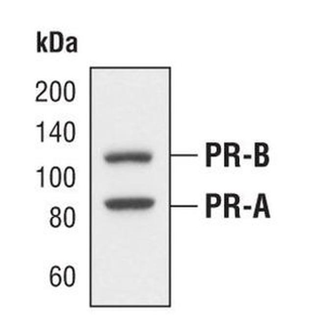 Progesterone Receptor Antibody in Western Blot (WB)