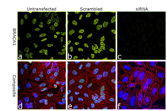 BRCA1 Antibody