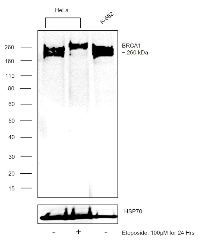 BRCA1 Antibody