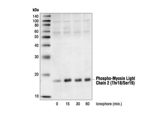 Phospho-MYL9 (Thr18, Ser19) Antibody in Western Blot (WB)