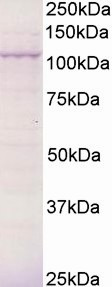 BCAR3 Antibody in Western Blot (WB)