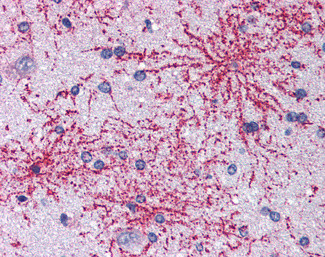 BAIAP2 Antibody in Immunohistochemistry (Paraffin) (IHC (P))