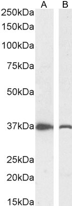 DDAH1 Antibody in Western Blot (WB)