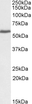 PRPF31 Antibody in Western Blot (WB)