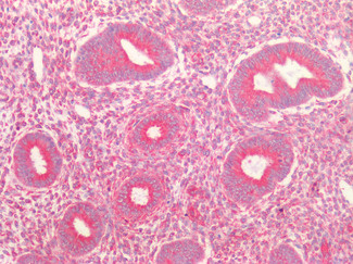 Kinesin 5B Antibody in Immunohistochemistry (Paraffin) (IHC (P))