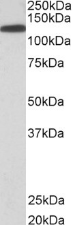 Kinesin 5B Antibody in Western Blot (WB)