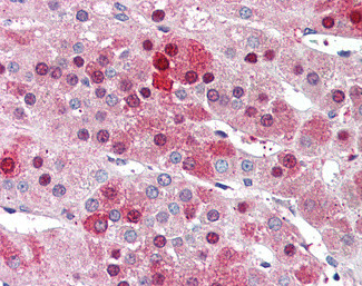 HEC1 Antibody in Immunohistochemistry (Paraffin) (IHC (P))