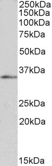 FOXB1 Antibody in Western Blot (WB)